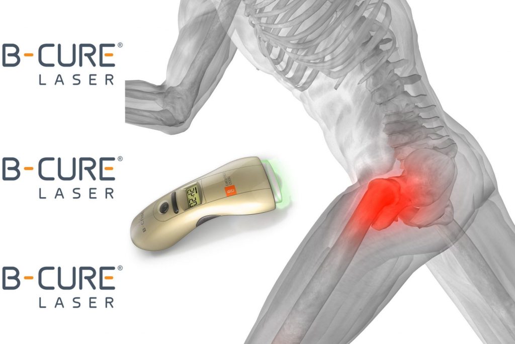 osteoartrita care implică genunchiul coxartroza articulației șoldului